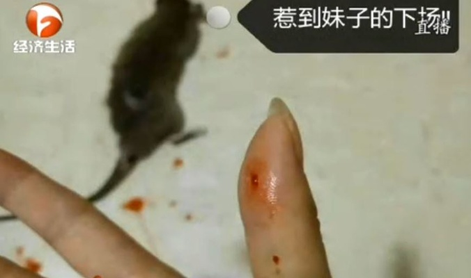 男子熟睡遭鼠咬破头，意外背后的深层思考
