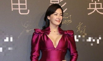 宋轶回应整容争议，自信之美，无需质疑其真实性