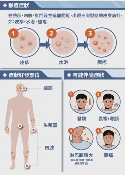 多国现猴痘病例，病毒传播链受关注