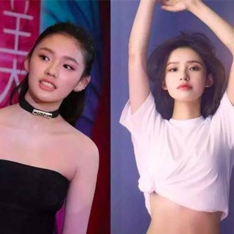 女生身体更容易出现淤青的原因分析