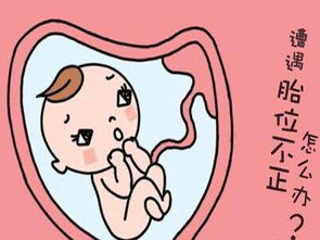 胎位不正怎么办？应对策略与注意事项全解析